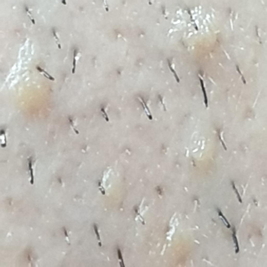 2번 째 사진