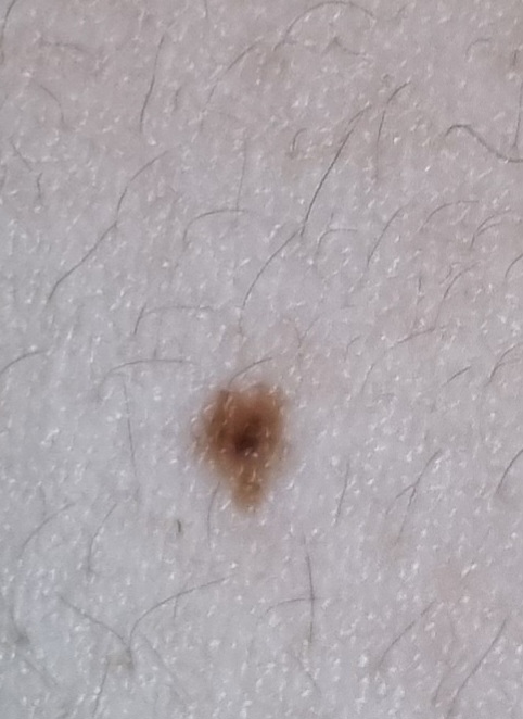 2번 째 사진