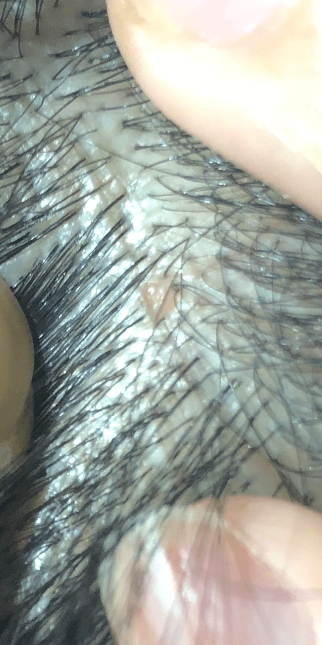 2번 째 사진