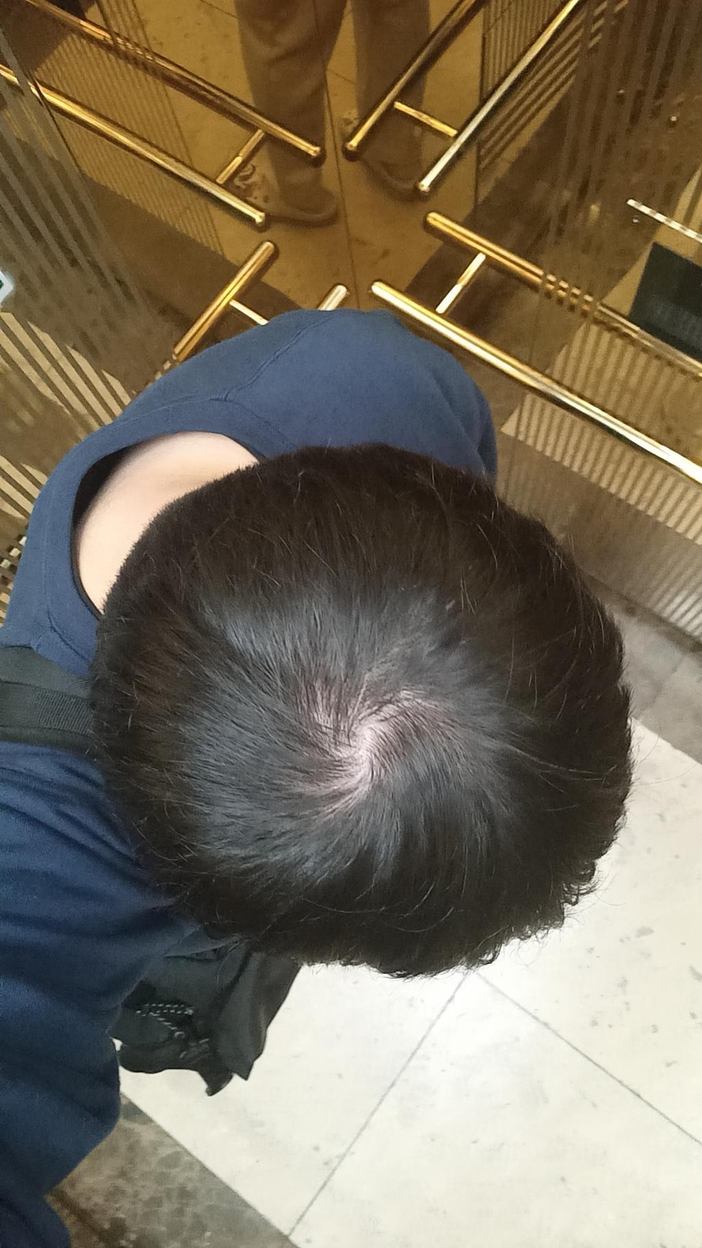 2번 째 사진