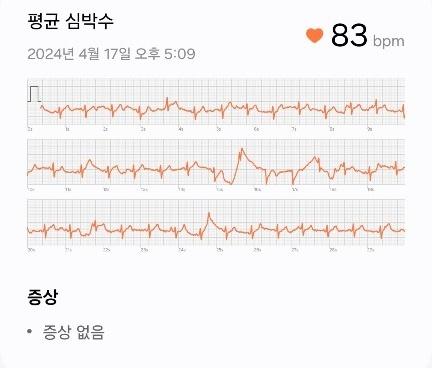 2번 째 사진