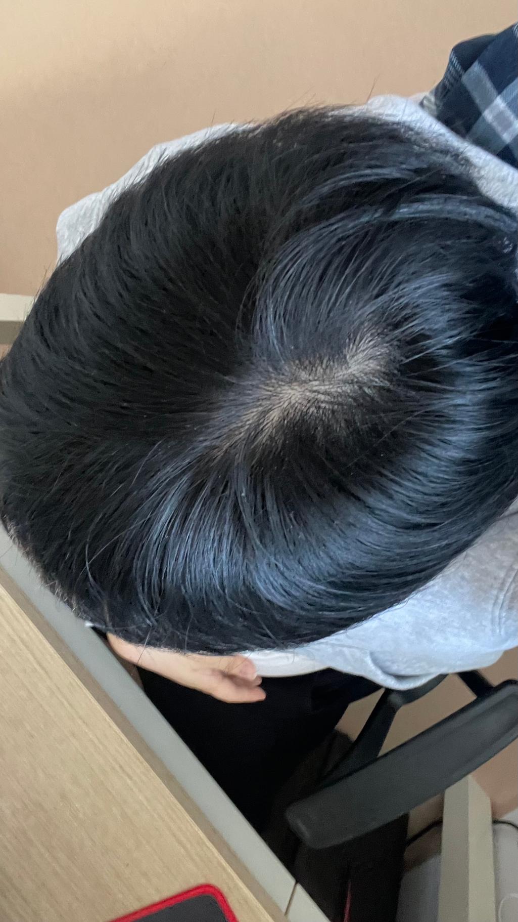 2번 째 사진