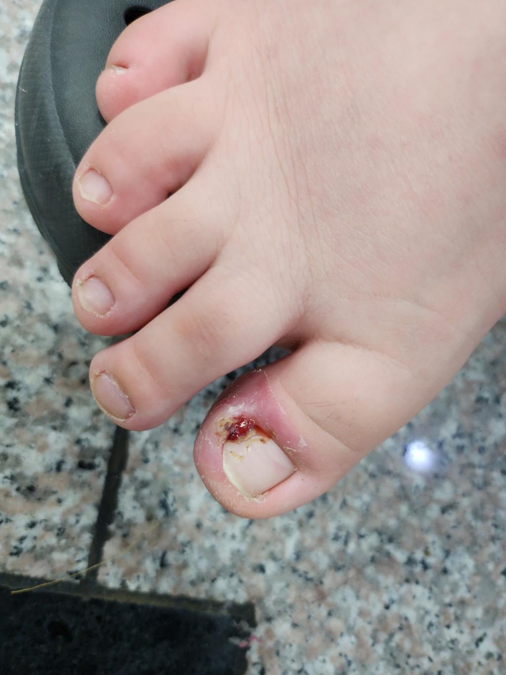 1번 째 사진