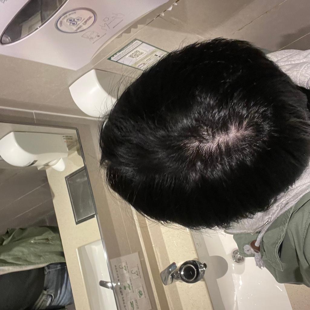 2번 째 사진