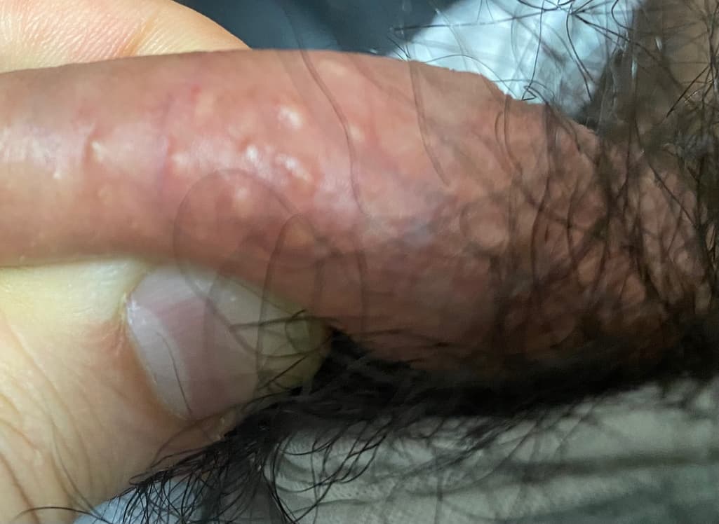 2번 째 사진