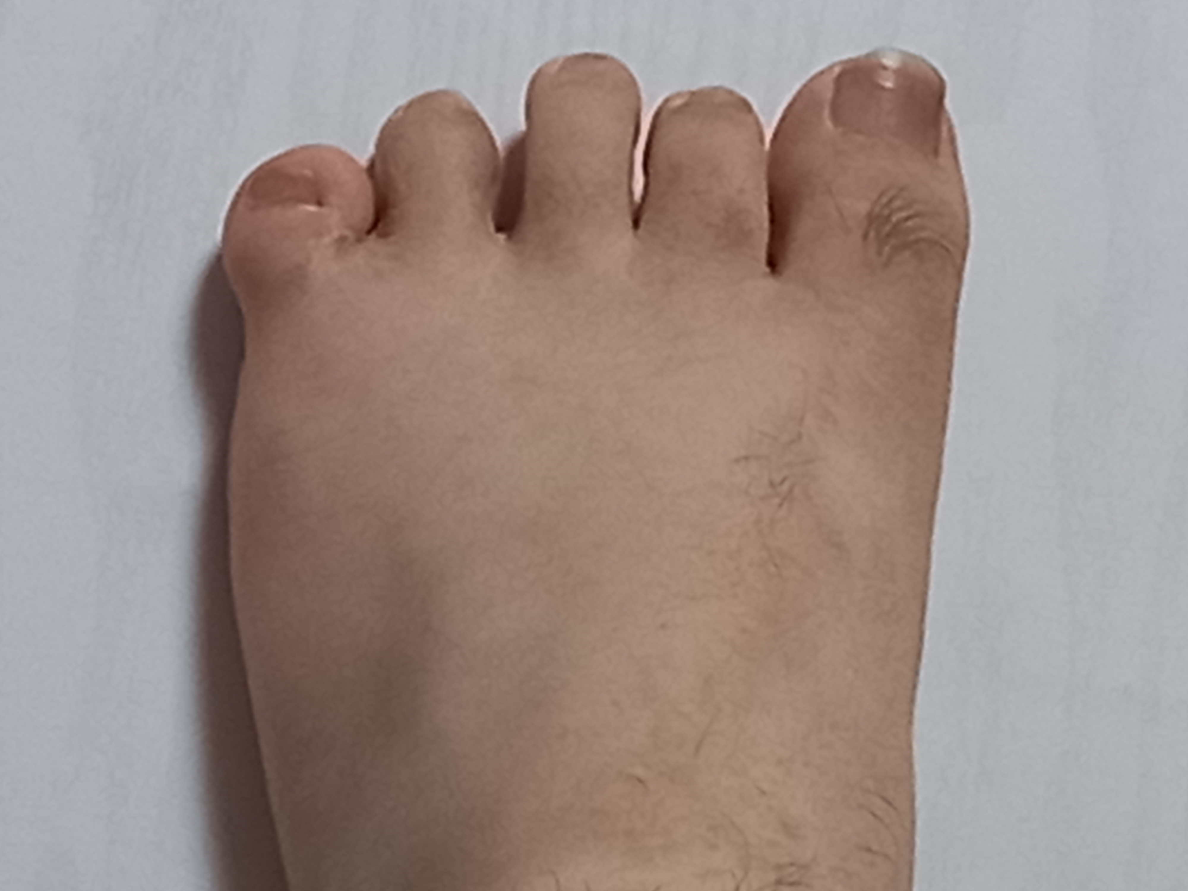 3번 째 사진