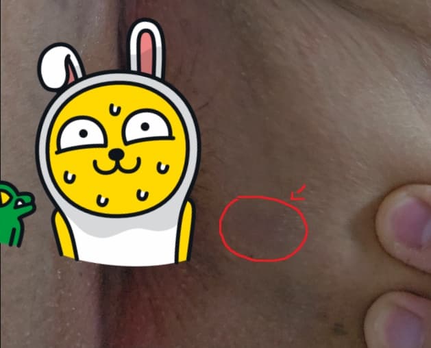 2번 째 사진