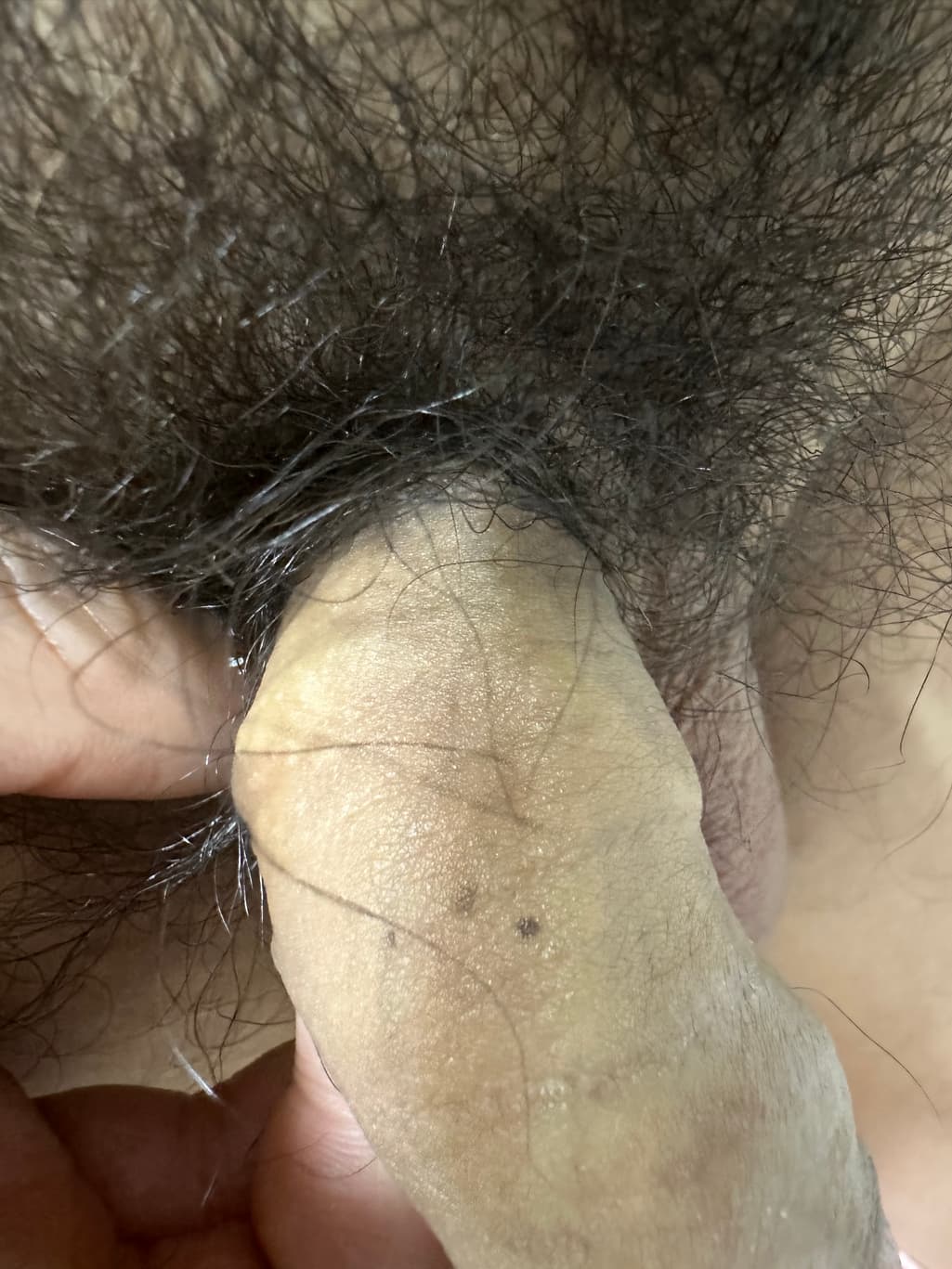 2번 째 사진