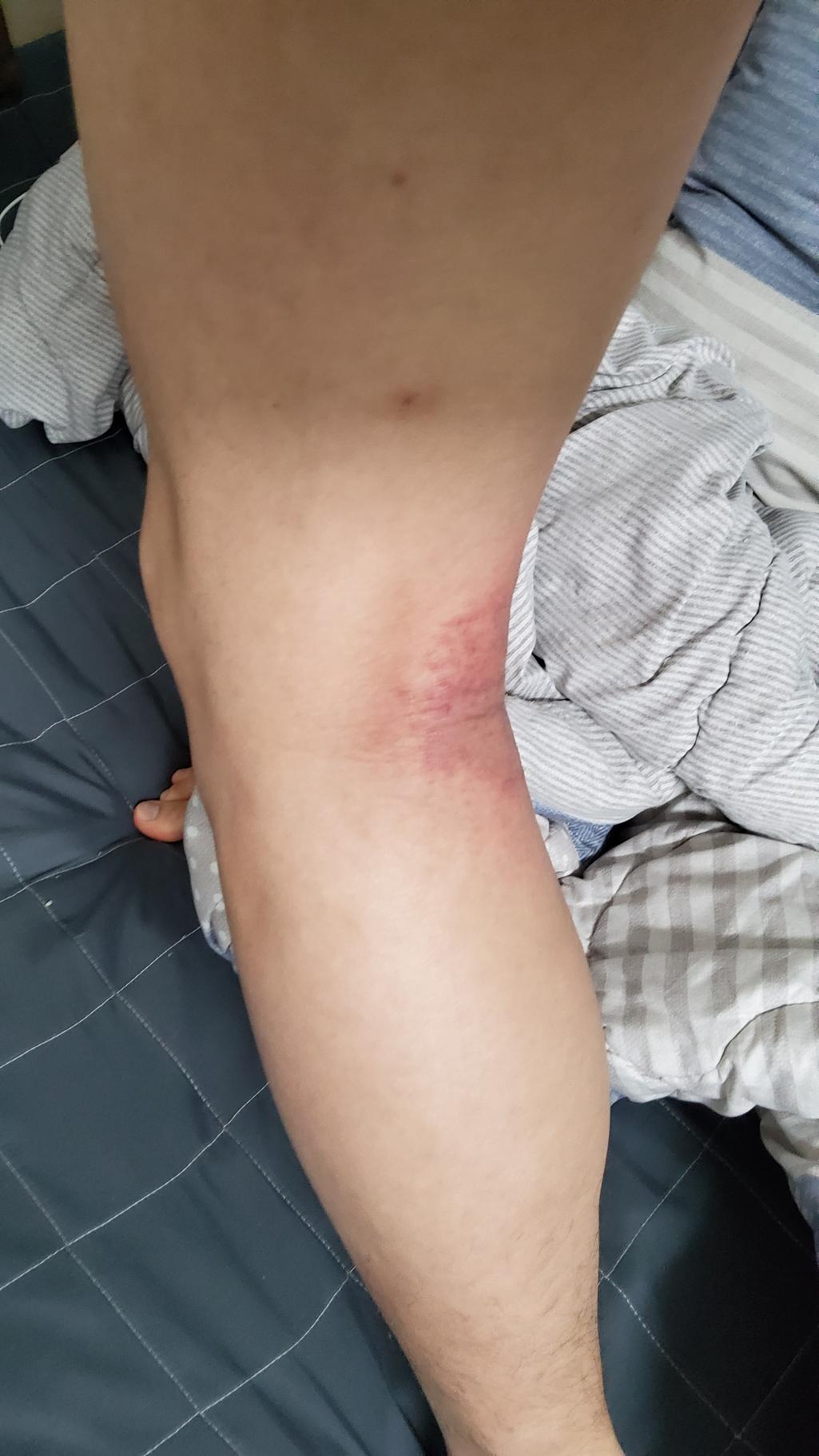 2번 째 사진