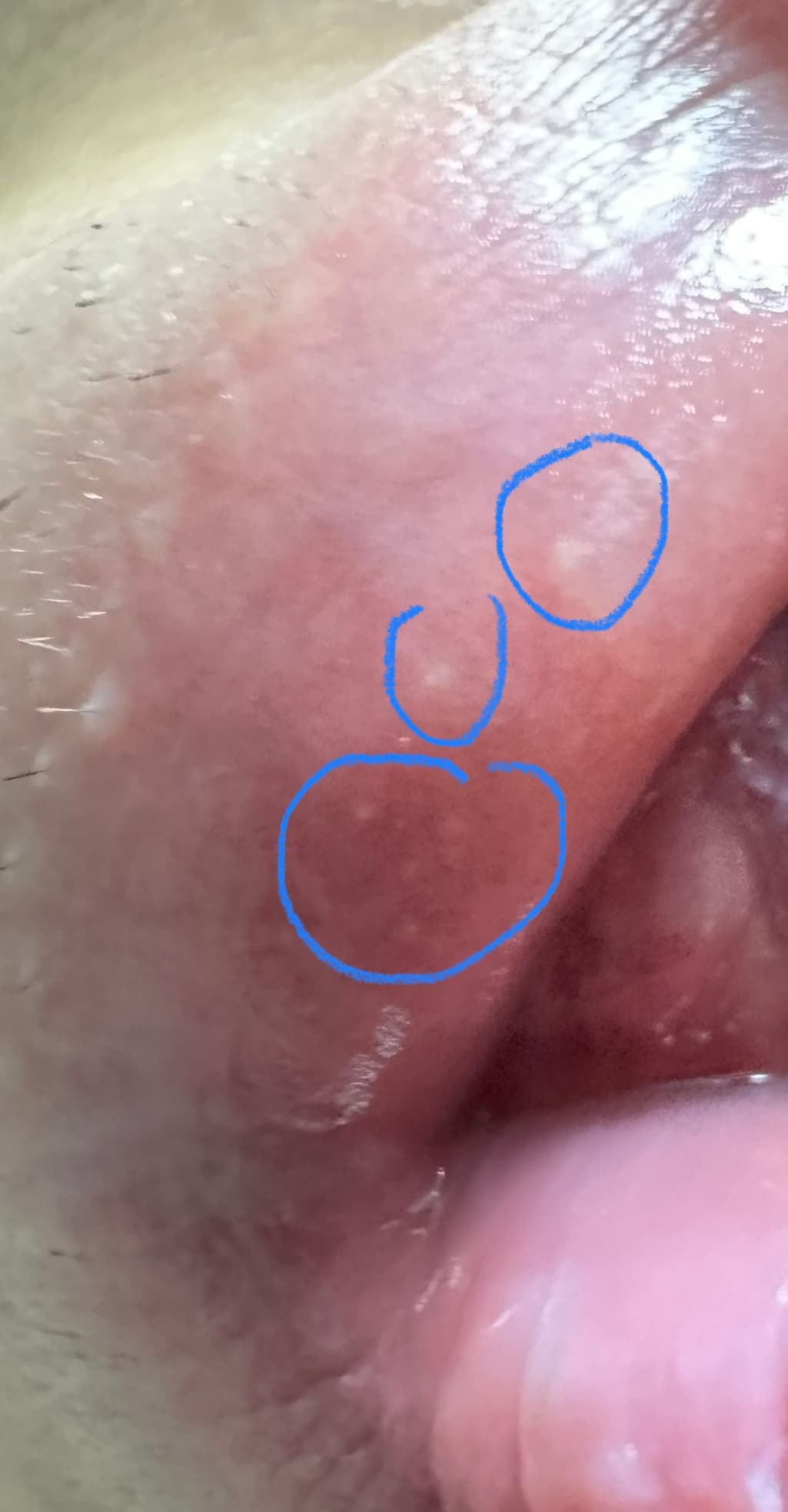 3번 째 사진