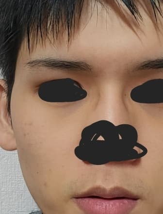 2번 째 사진