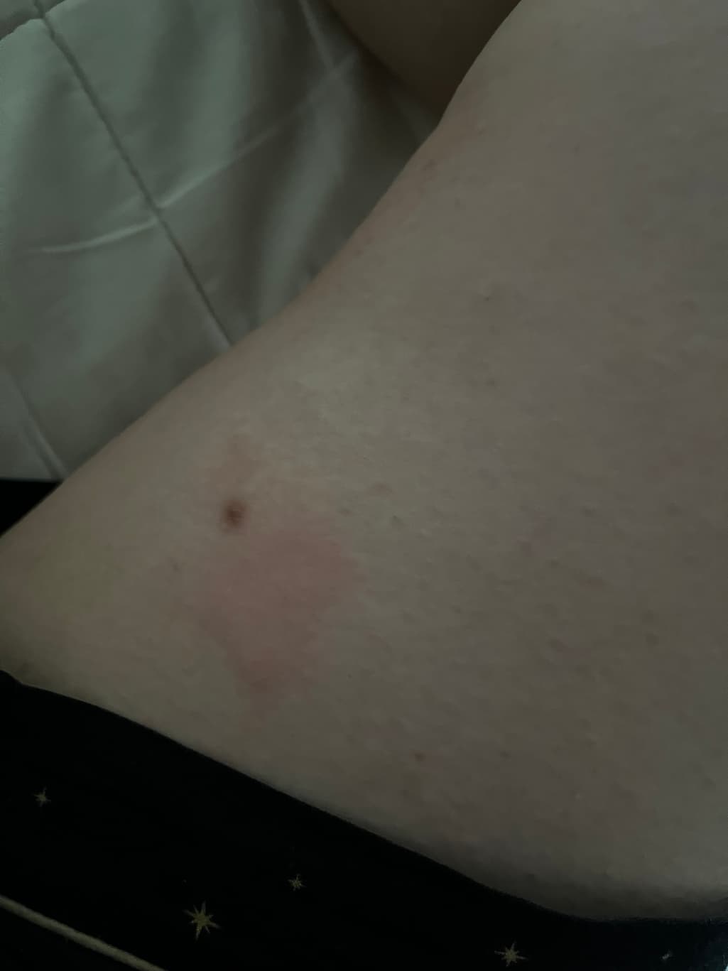 2번 째 사진