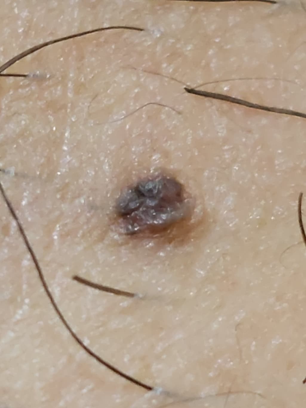 2번 째 사진