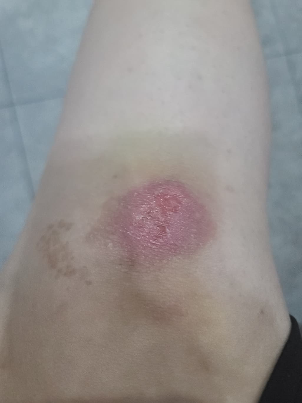 1번 째 사진