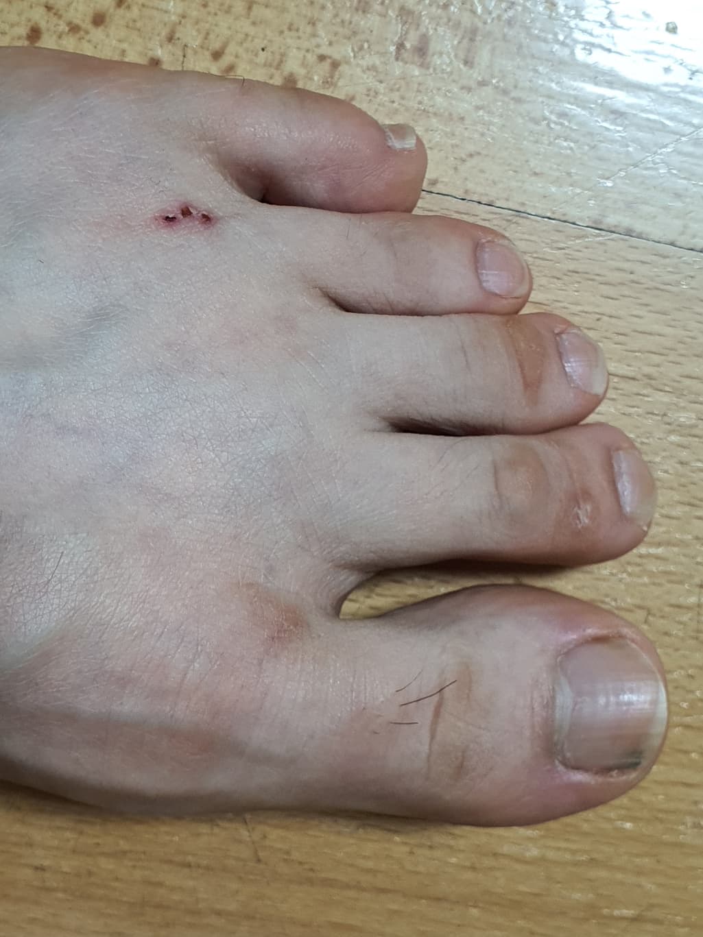 2번 째 사진