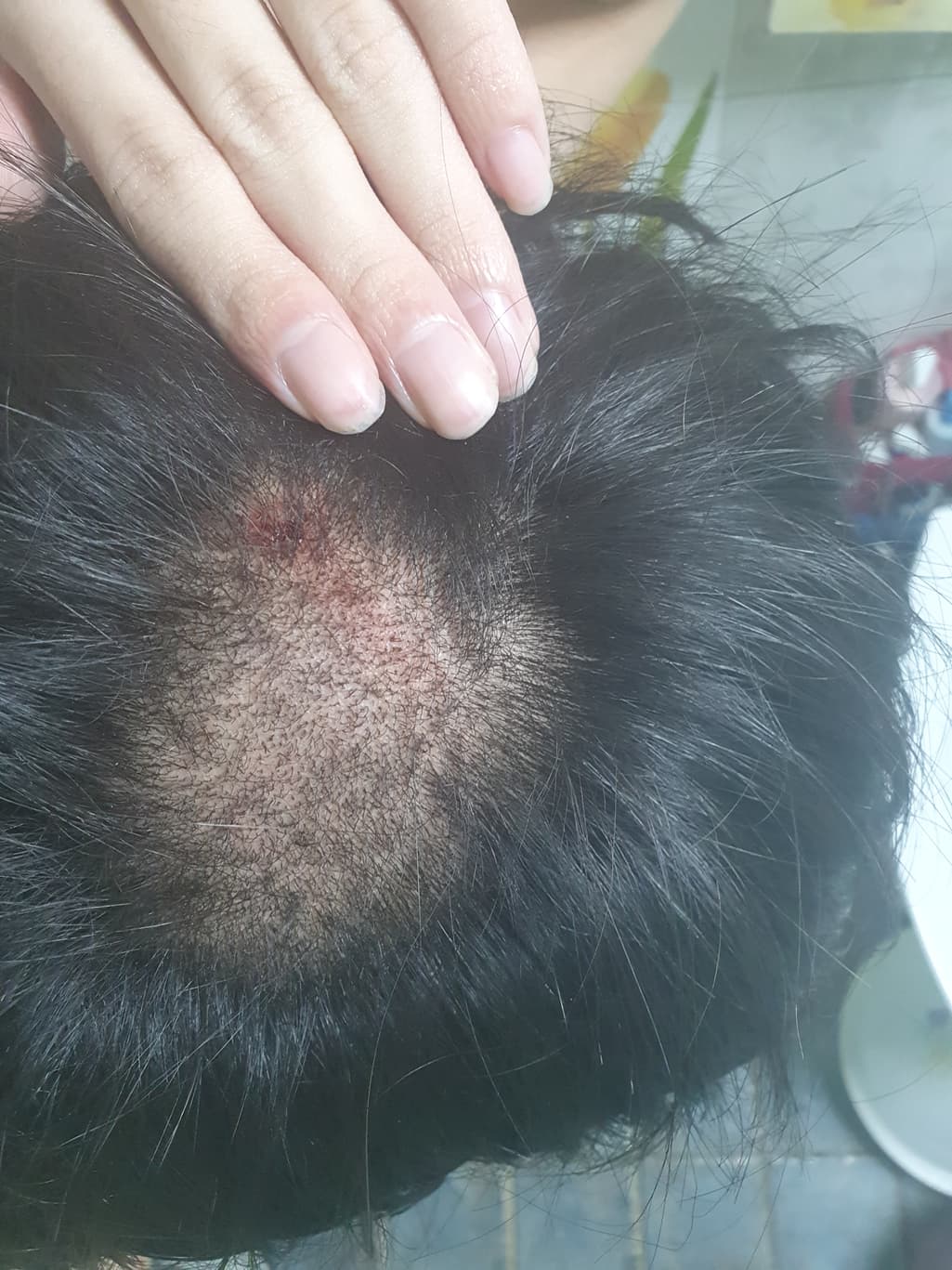 1번 째 사진