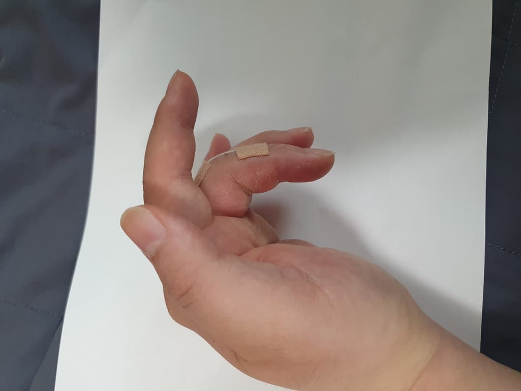 2번 째 사진