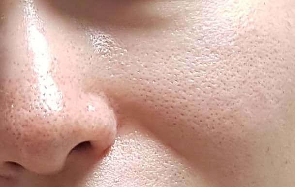 2번 째 사진