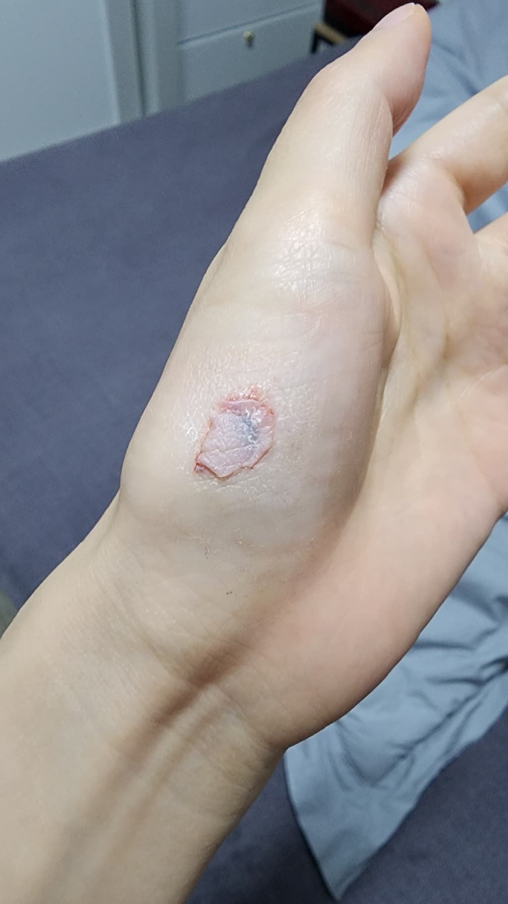 2번 째 사진