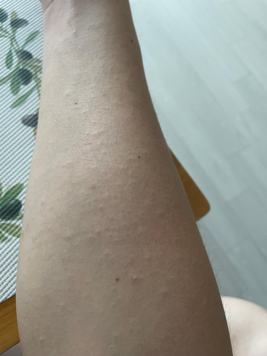 2번 째 사진