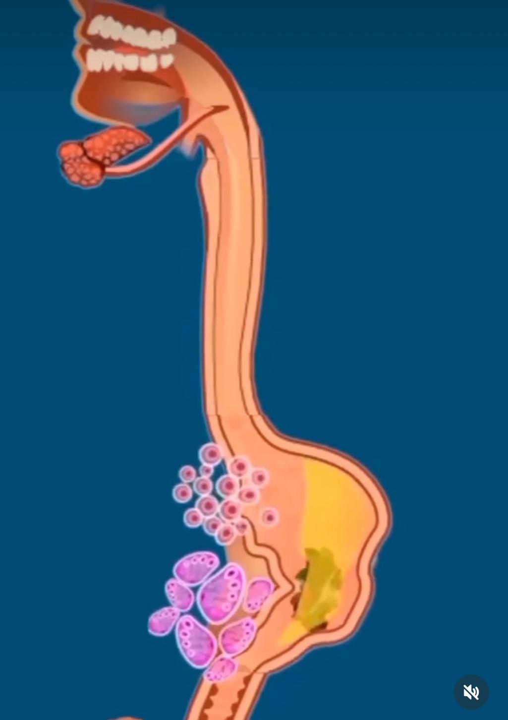 2번 째 사진