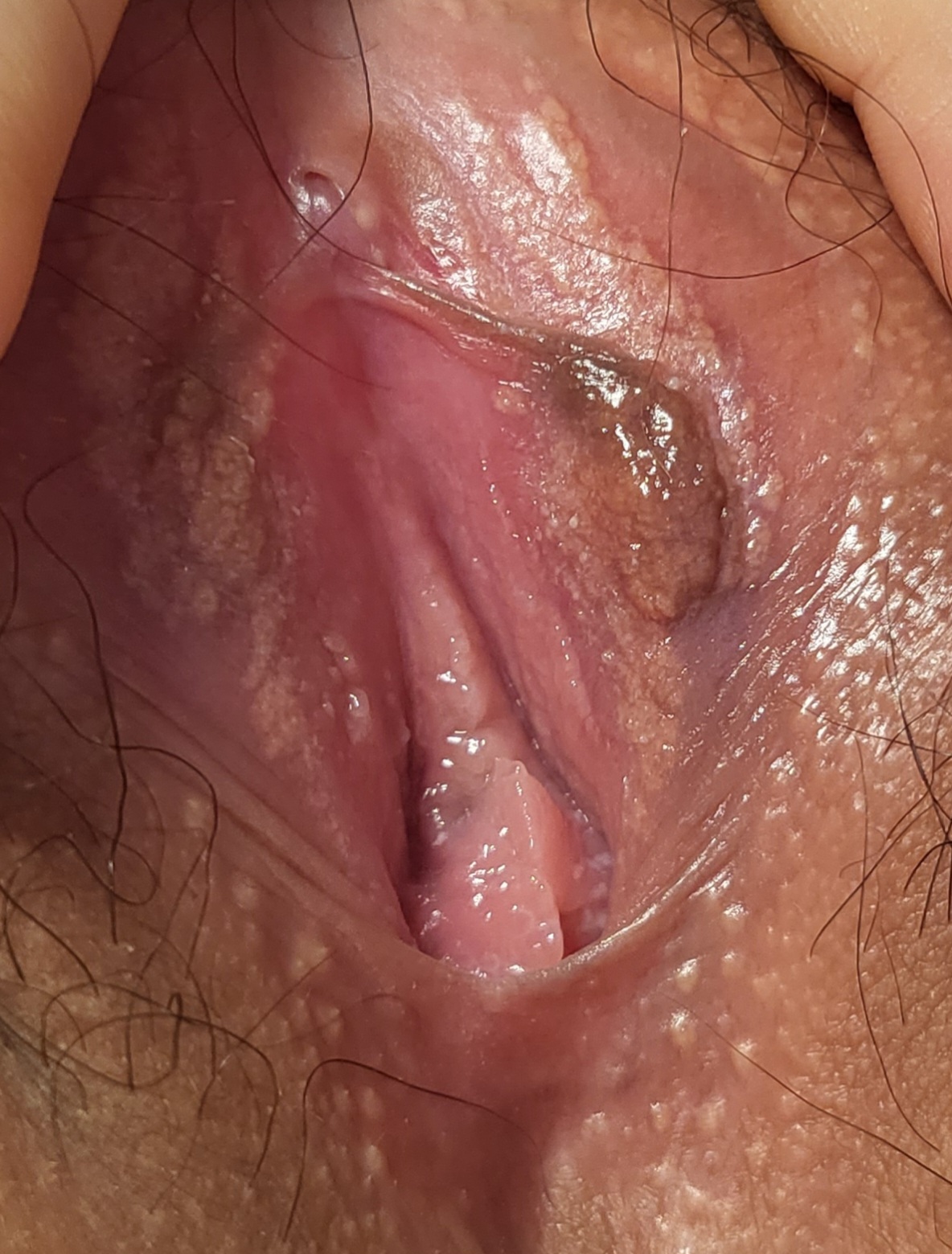 4번 째 사진