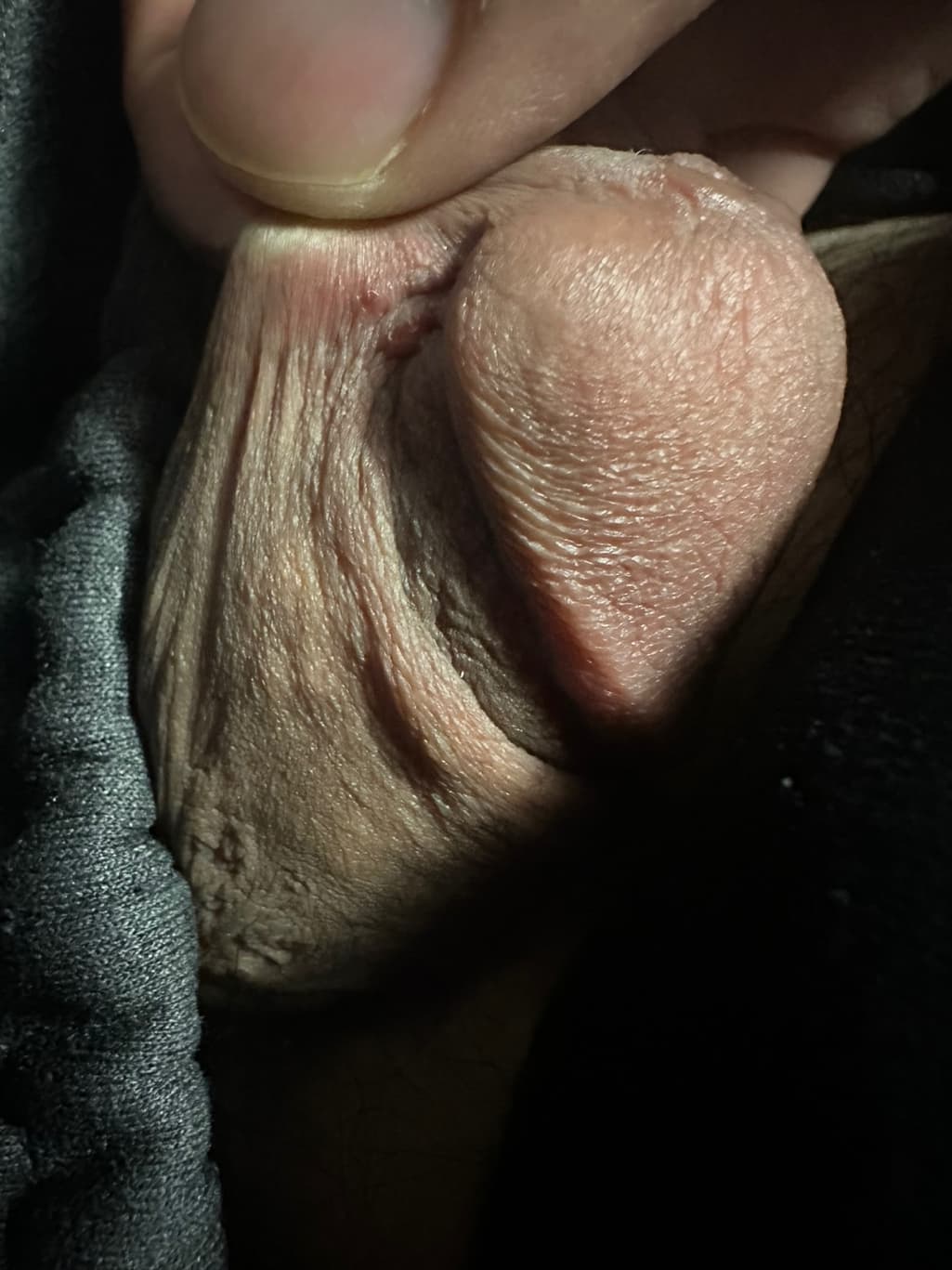 2번 째 사진