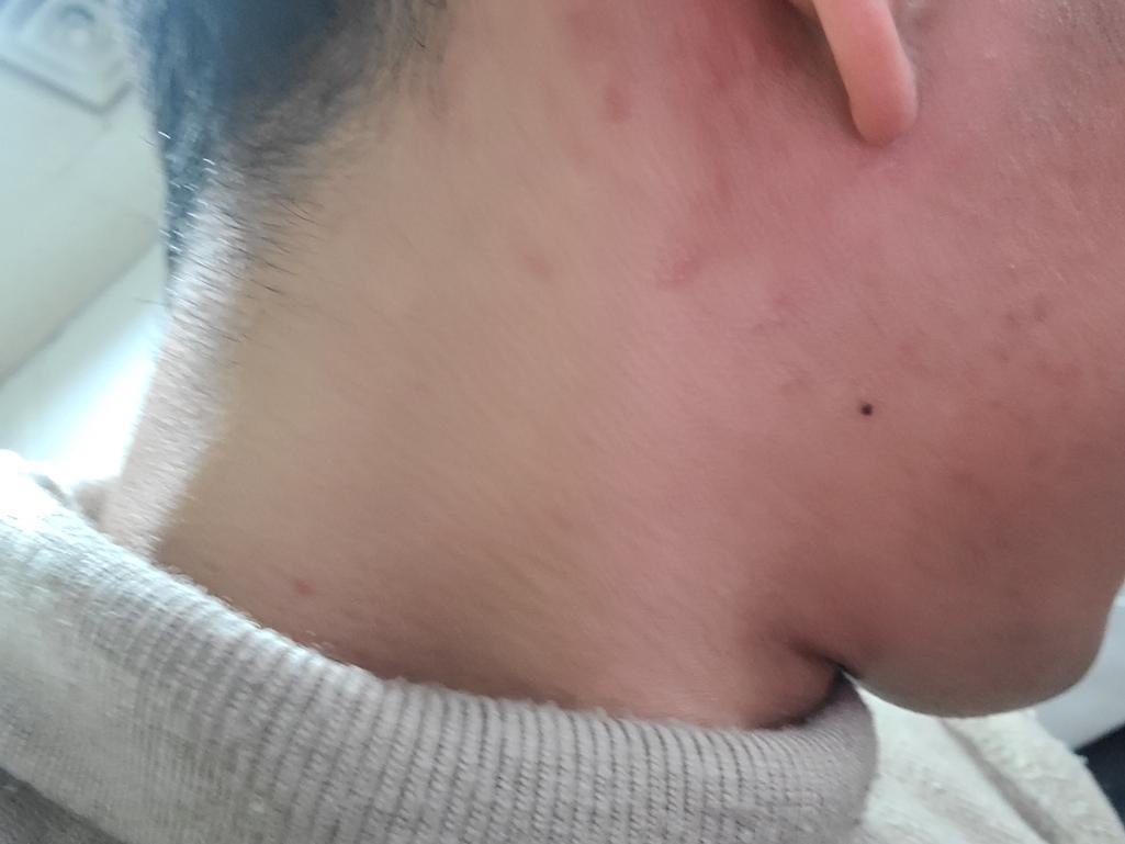 2번 째 사진