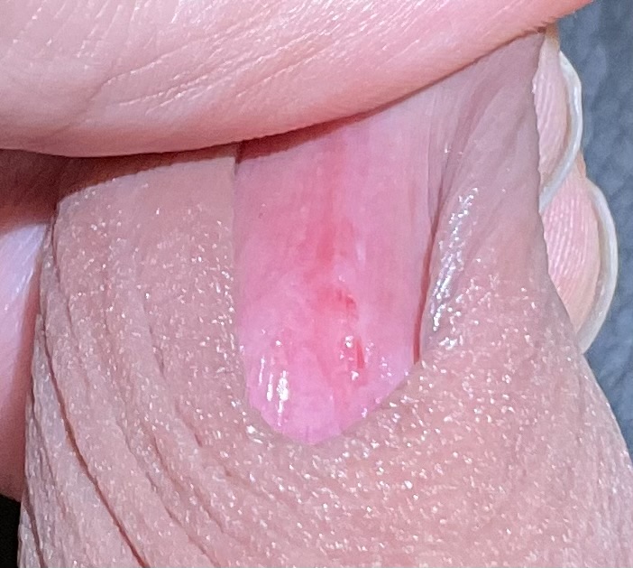 2번 째 사진