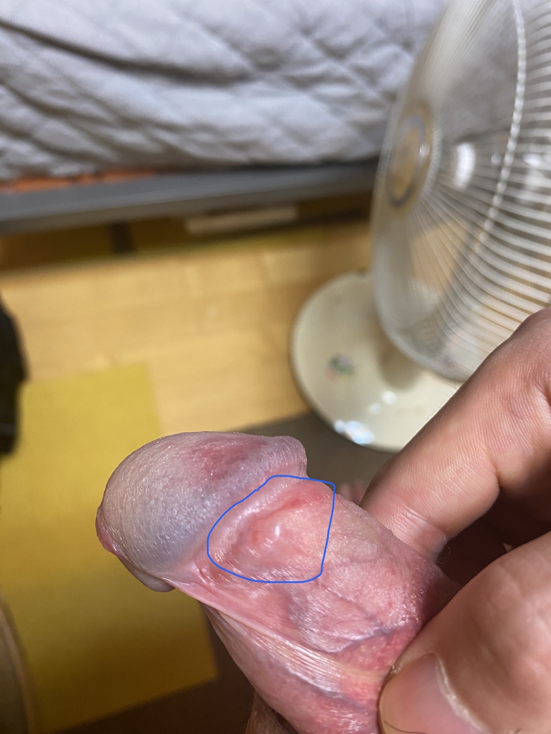 3번 째 사진