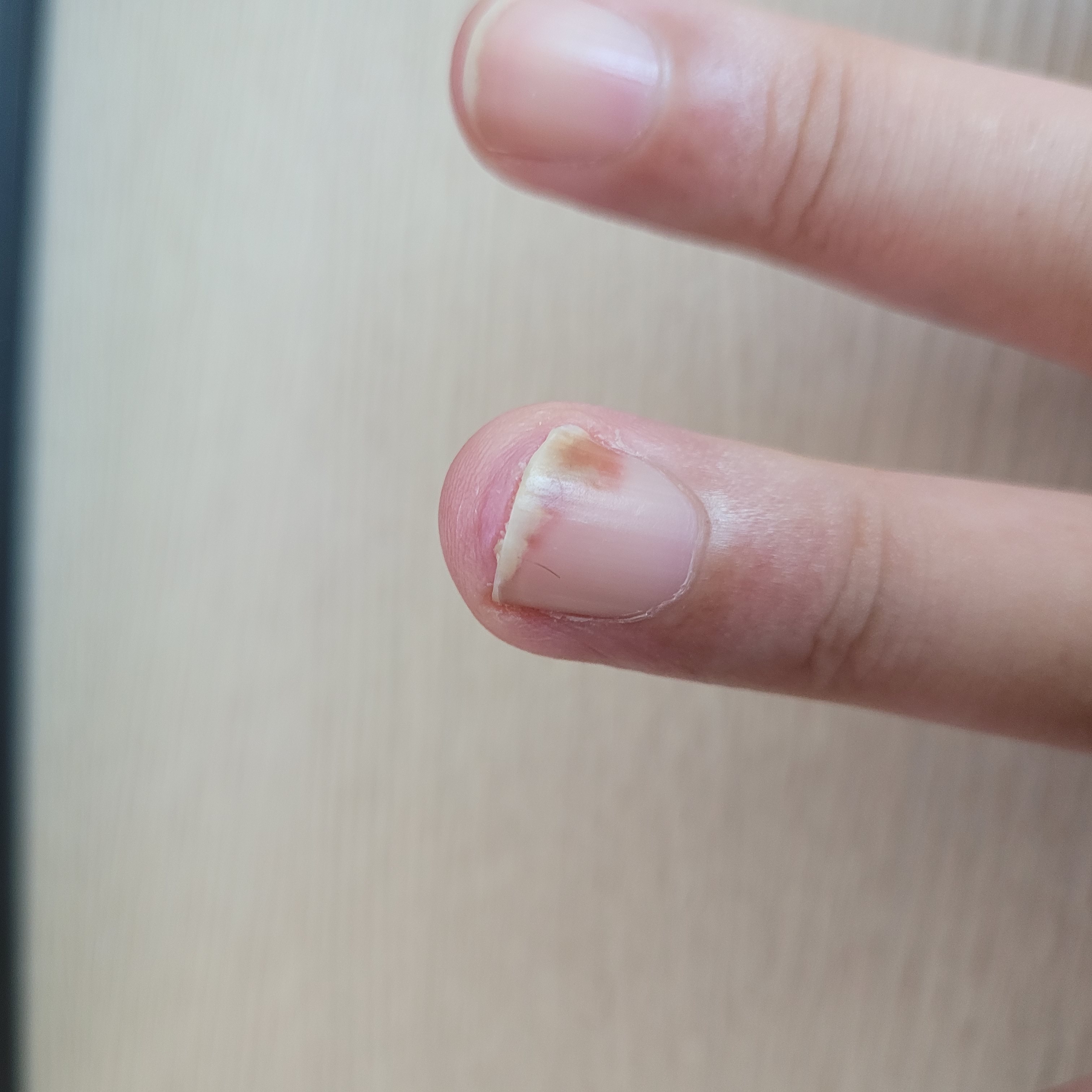 3번 째 사진