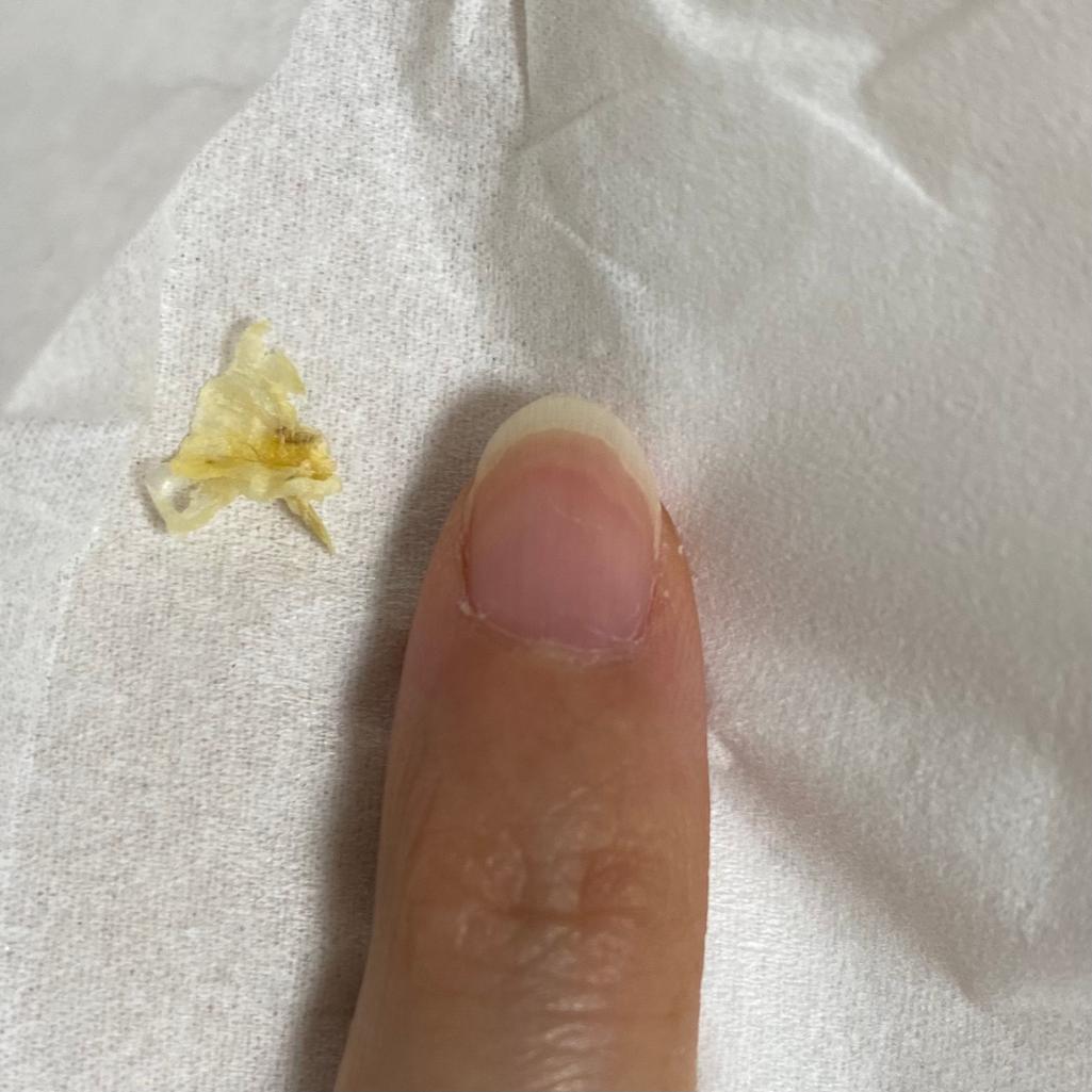 2번 째 사진