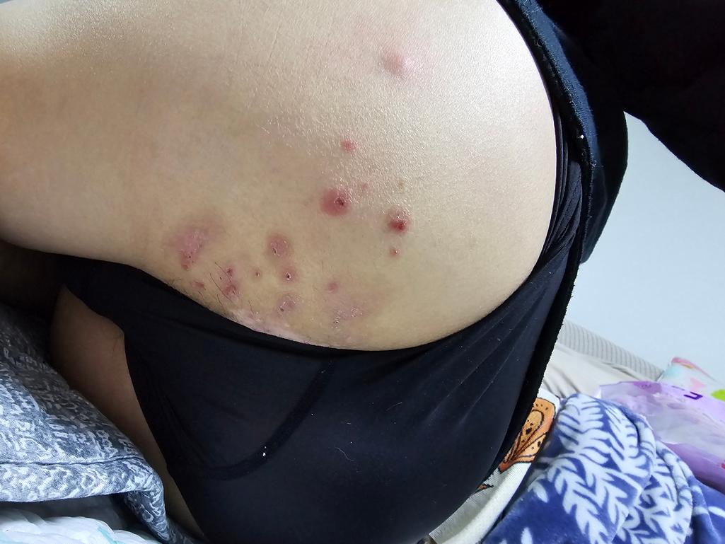 1번 째 사진