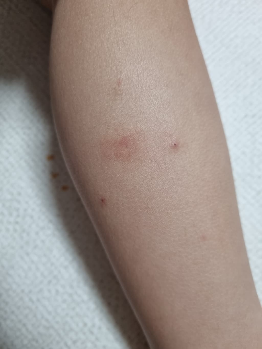 2번 째 사진