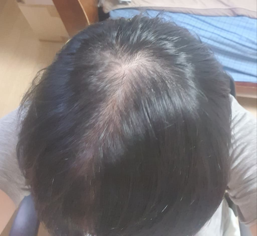 1번 째 사진