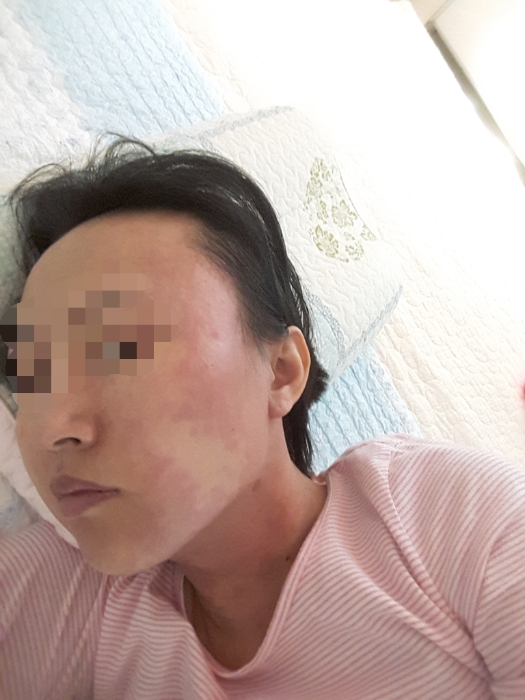 2번 째 사진