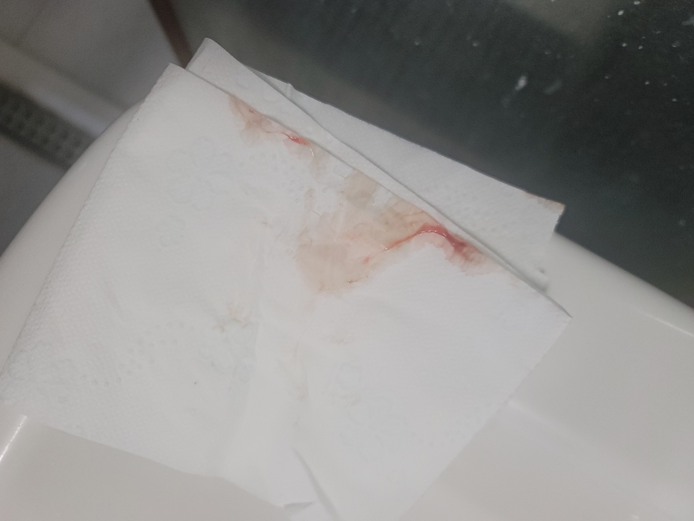 2번 째 사진