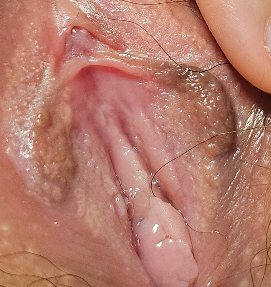 3번 째 사진