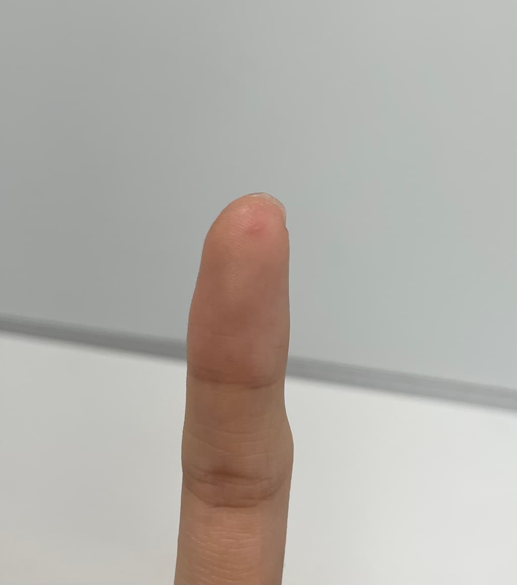 2번 째 사진