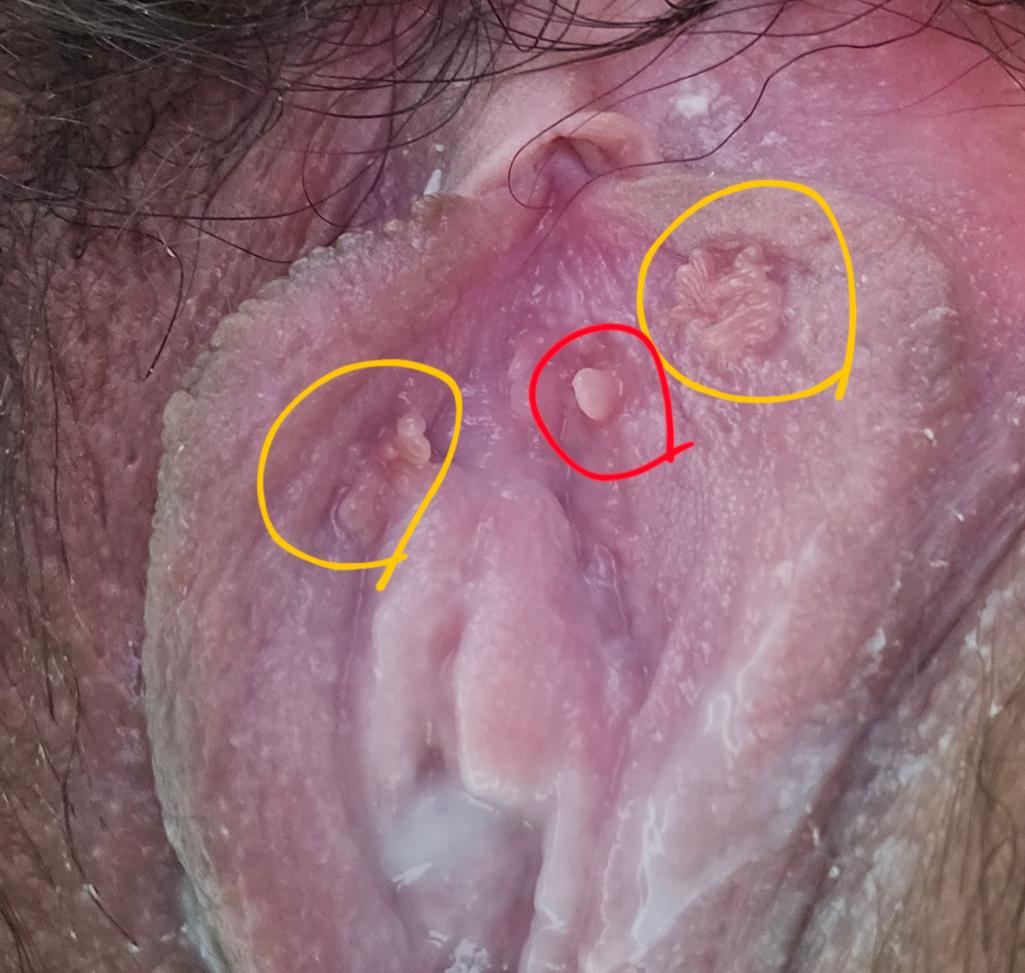 2번 째 사진