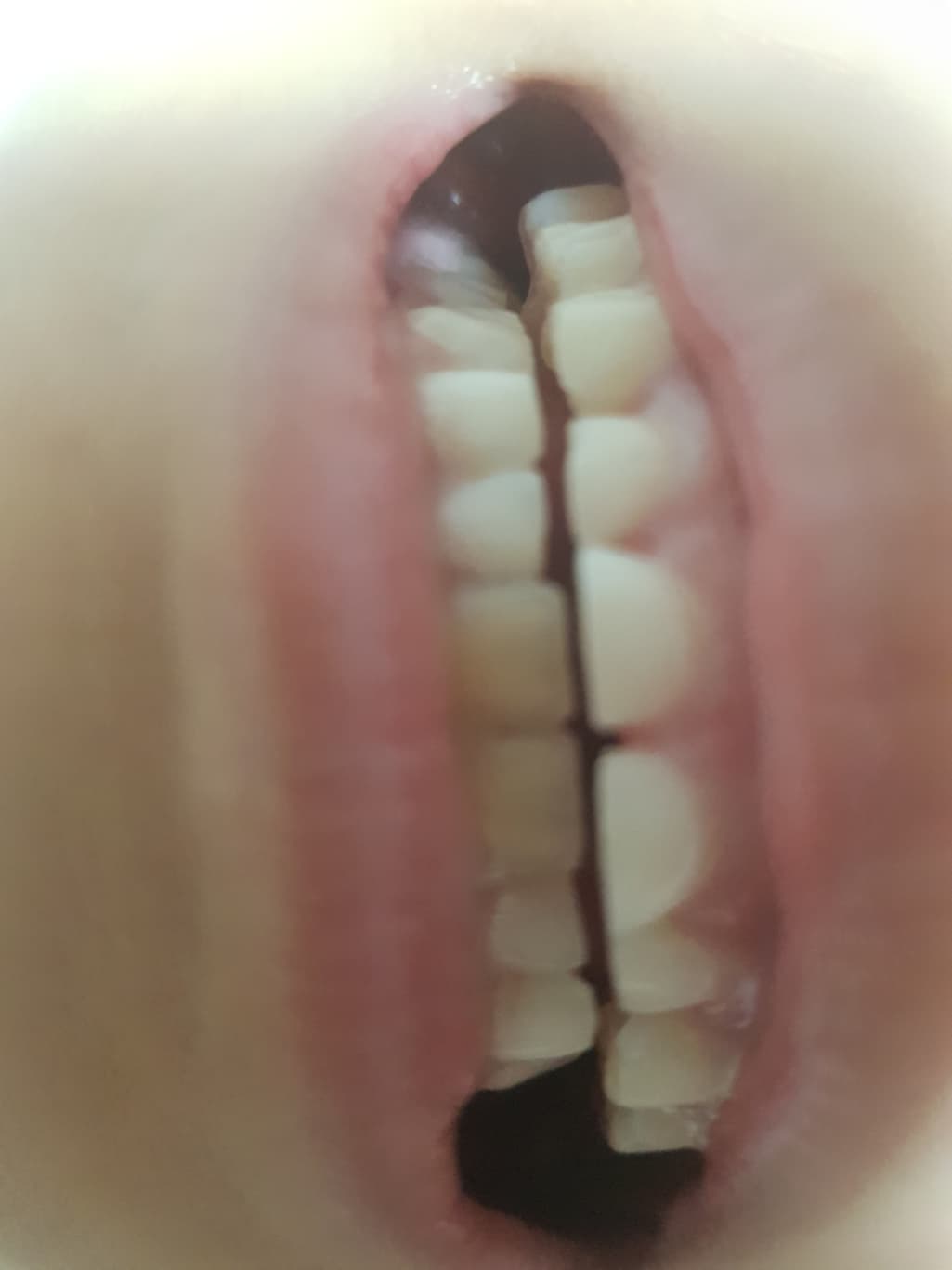 2번 째 사진