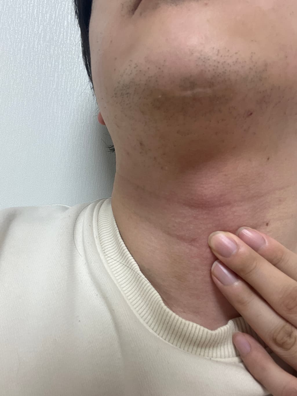 2번 째 사진