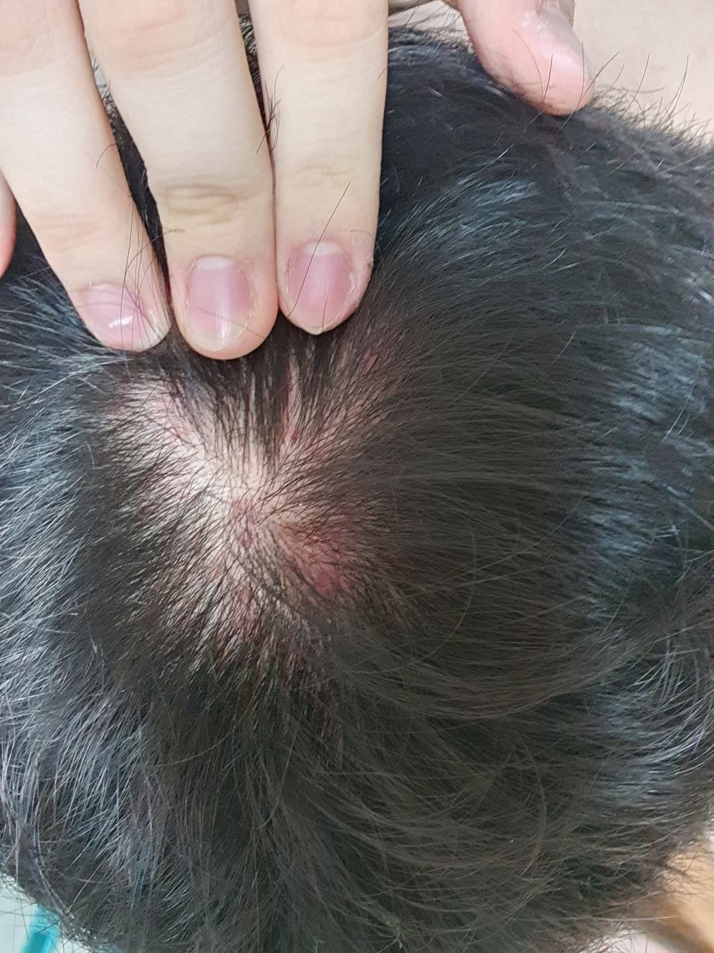 2번 째 사진