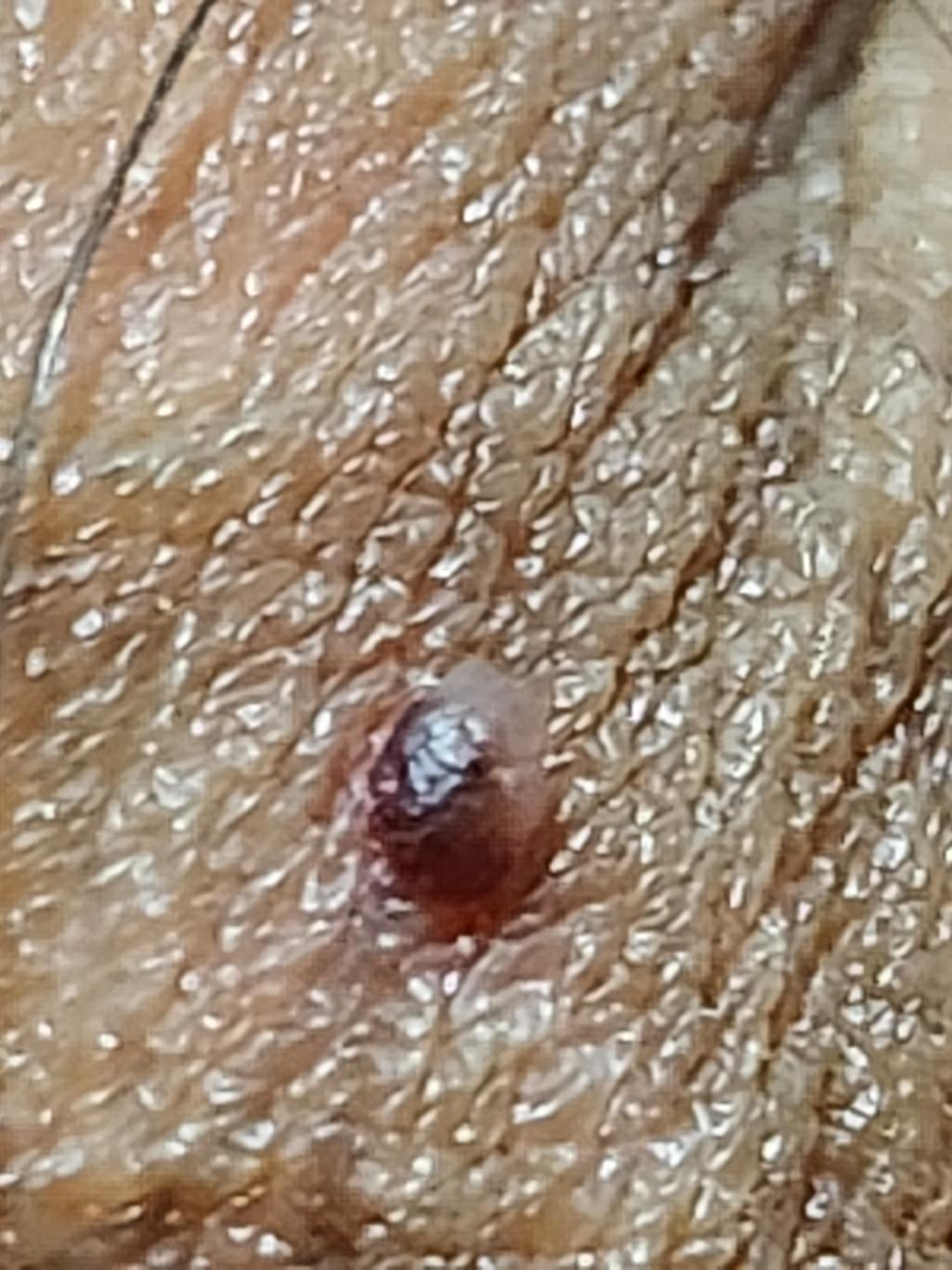 2번 째 사진