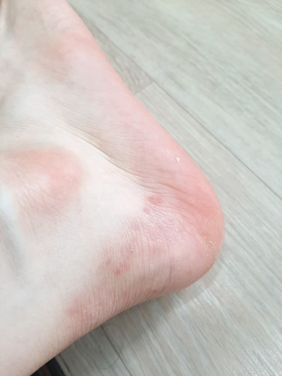2번 째 사진