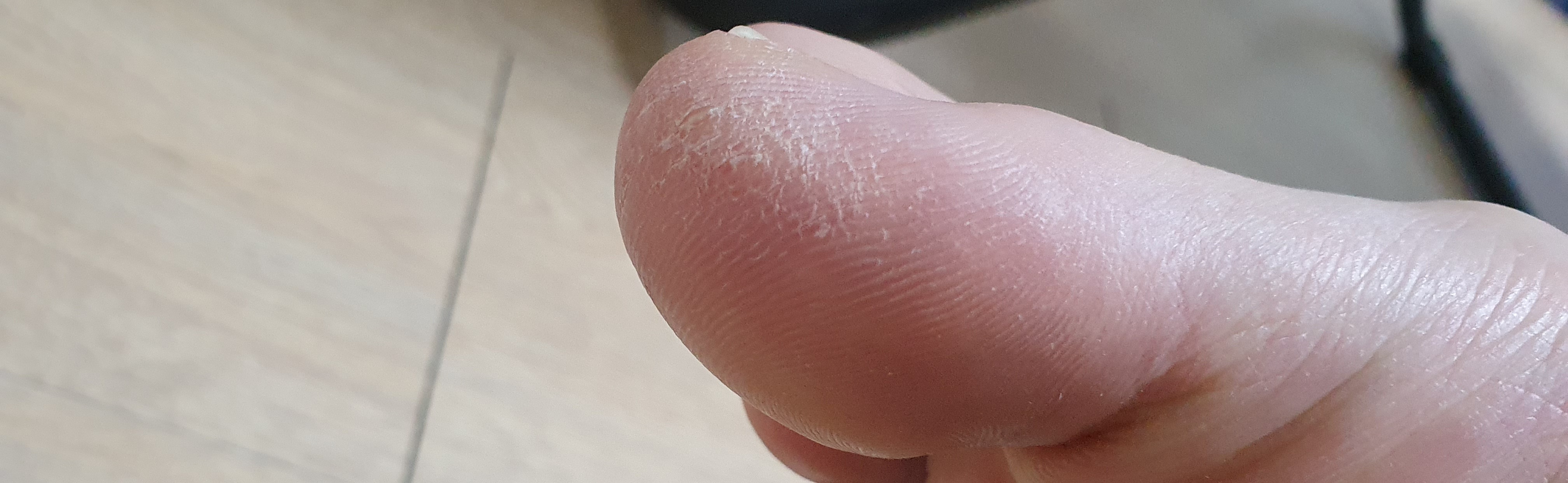 2번 째 사진