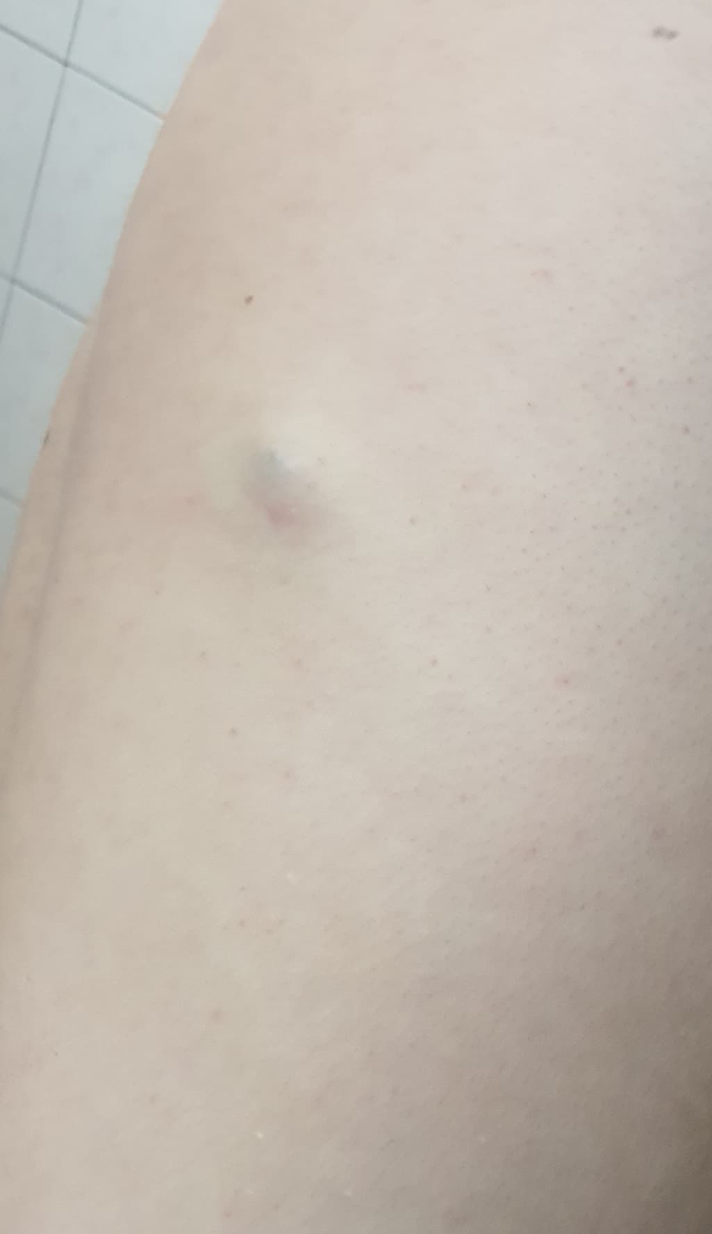 2번 째 사진