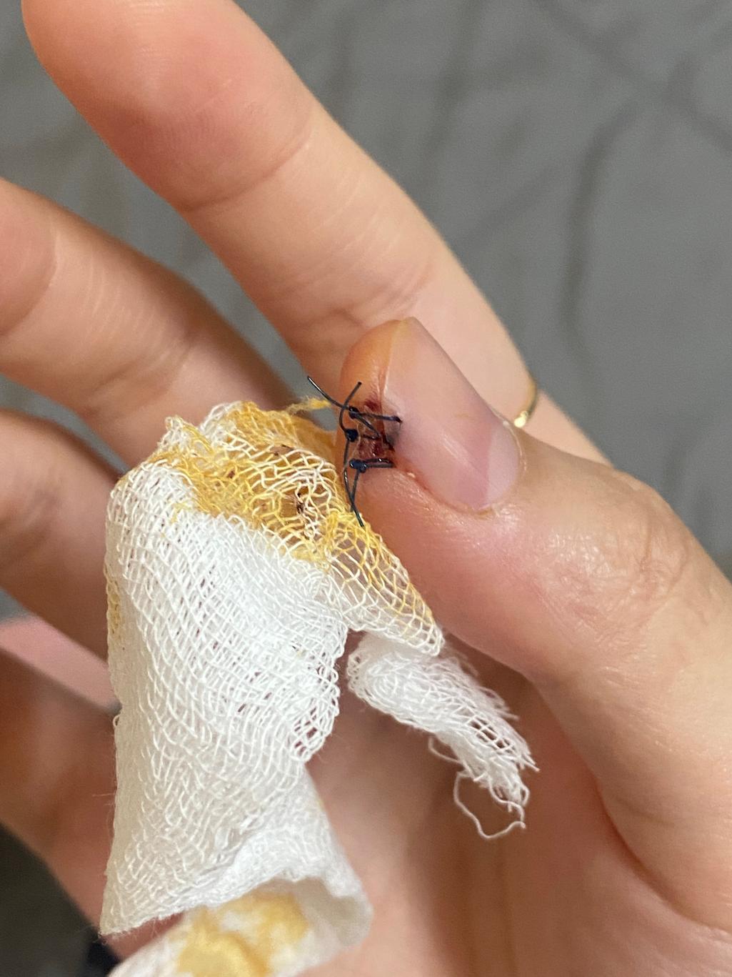 1번 째 사진