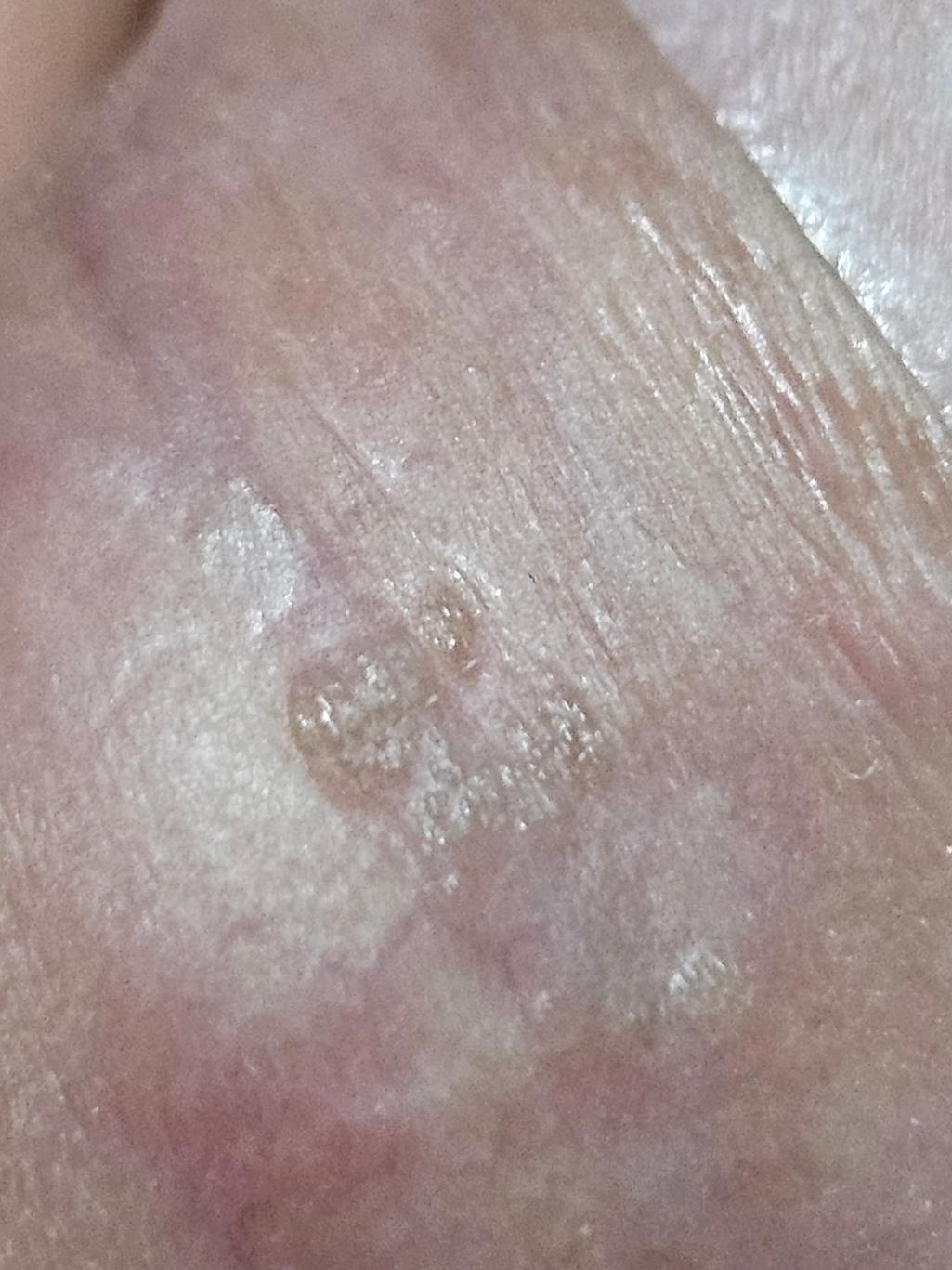 2번 째 사진