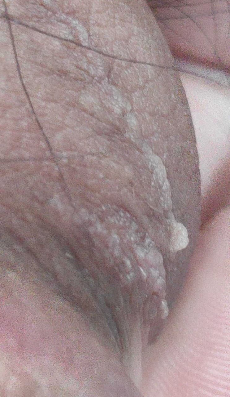 3번 째 사진